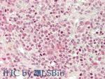 CXCL2 Antibody in Immunohistochemistry (Paraffin) (IHC (P))