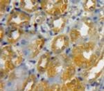 beta-3 Defensin Antibody in Immunohistochemistry (Paraffin) (IHC (P))