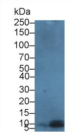 beta-3 Defensin Antibody in Western Blot (WB)