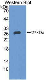 BCMO1 Antibody in Western Blot (WB)