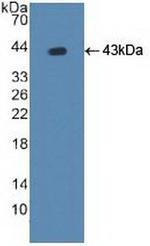 ATP7B Antibody in Western Blot (WB)