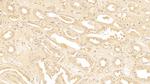 SERPINA3 Antibody in Immunohistochemistry (Paraffin) (IHC (P))