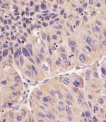 ACSL4 Antibody in Immunohistochemistry (Paraffin) (IHC (P))