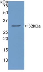 Amylase alpha Antibody in Western Blot (WB)