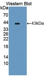 ADAMTS16 Antibody in Western Blot (WB)