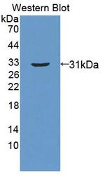 ABCC11 Antibody in Western Blot (WB)