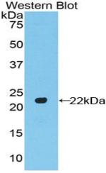 A26C2 Antibody in Western Blot (WB)