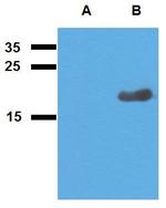 Mycobacterium tuberculosis Acr2 Antibody in Western Blot (WB)