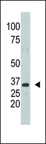 SULT1A1 Antibody in Western Blot (WB)