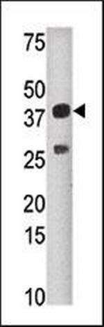 SULT1C2 Antibody in Western Blot (WB)