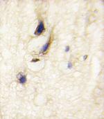 DAAM1 Antibody in Immunohistochemistry (Paraffin) (IHC (P))