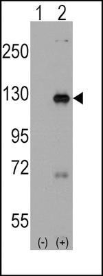 DAAM1 Antibody in Western Blot (WB)