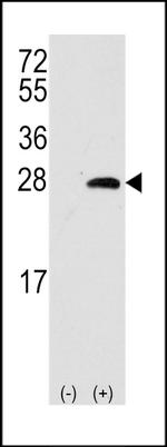 Sigma-1 Receptor Antibody in Western Blot (WB)