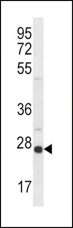 Sigma-1 Receptor Antibody in Western Blot (WB)