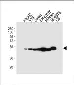 NSE Antibody in Western Blot (WB)