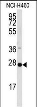 PPAP2C Antibody in Western Blot (WB)