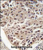 SRSF2 Antibody in Immunohistochemistry (Paraffin) (IHC (P))