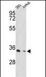 PSMD11 Antibody in Western Blot (WB)