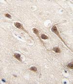 RUNX1 Antibody in Immunohistochemistry (Paraffin) (IHC (P))