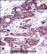 NPM1 Antibody in Immunohistochemistry (Paraffin) (IHC (P))