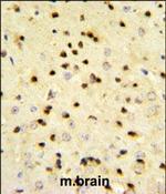 EBP1 Antibody in Immunohistochemistry (Paraffin) (IHC (P))