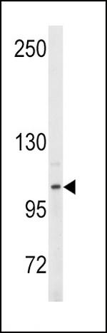 ENPP2 Antibody in Western Blot (WB)