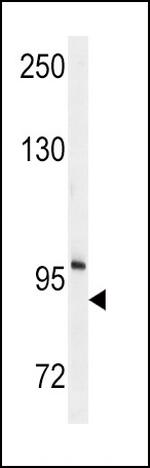 ENPP2 Antibody in Western Blot (WB)