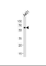 HSP60 Antibody in Western Blot (WB)