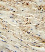 CD105 Antibody in Immunohistochemistry (Paraffin) (IHC (P))