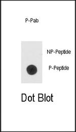 Phospho-BAD (Ser99) Antibody in Dot Blot (DB)