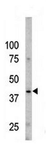 Phospho-Caspase 9 (Ser196) Antibody in Western Blot (WB)