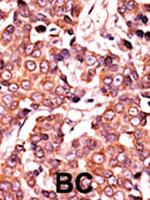 Phospho-Cdc25A (Ser278) Antibody in Immunohistochemistry (Paraffin) (IHC (P))