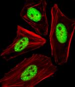 Phospho-Cdc25A (Thr507) Antibody in Immunocytochemistry (ICC/IF)