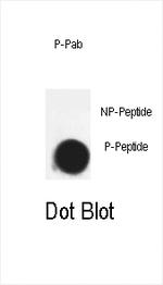 Phospho-CDK7 (Thr170) Antibody in Dot Blot (DB)