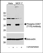 Phospho-CDK7 (Thr170) Antibody in Western Blot (WB)