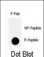 Phospho-PKMYT1 (Thr495) Antibody in Dot Blot (DB)