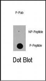 Phospho-p300 (Ser89) Antibody in Dot Blot (DB)