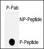 Phospho-p53 (Thr18) Antibody in Dot Blot (DB)