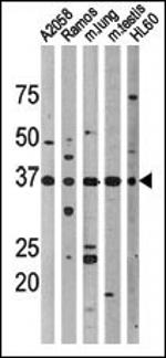 Phospho-p53 (Thr18) Antibody in Western Blot (WB)