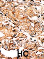 Phospho-RAD9 (Ser277) Antibody in Immunohistochemistry (Paraffin) (IHC (P))