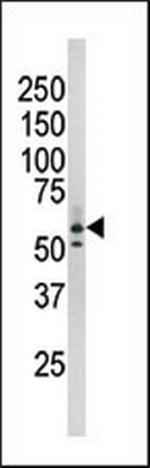 Phospho-RAD9 (Ser277) Antibody in Western Blot (WB)