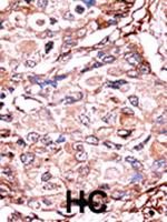 Phospho-SMAD3 (Ser213) Antibody in Immunohistochemistry (Paraffin) (IHC (P))