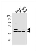 Phospho-SMAD3 (Ser213) Antibody in Western Blot (WB)