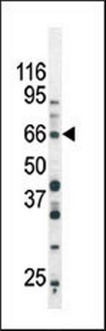 Phospho-SMAD3 (Ser213) Antibody in Western Blot (WB)