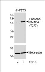 Phospho-SMAD4 (Thr277) Antibody in Western Blot (WB)