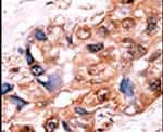 Phospho-YES1/SRC (Tyr537, Tyr530) Antibody in Immunohistochemistry (Paraffin) (IHC (P))