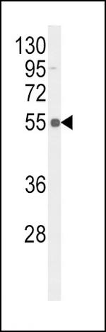 Phospho-TNFR1 (Ser274) Antibody in Western Blot (WB)