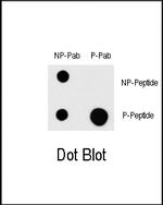 Phospho-MEKK1 (Thr1383) Antibody in Dot Blot (DB)