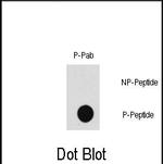 Phospho-TAK1 (Thr187) Antibody in Dot Blot (DB)