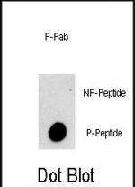 Phospho-VPS34 (Ser282) Antibody in Dot Blot (DB)